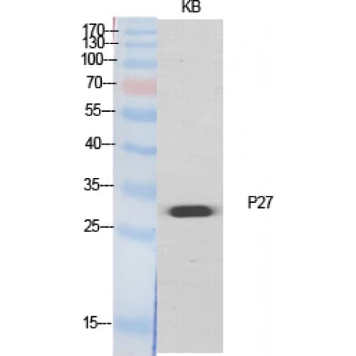 Polyclonal Rabbit anti-Human CDKN1B / p27 Kip1 Antibody (140-220 aa, WB)