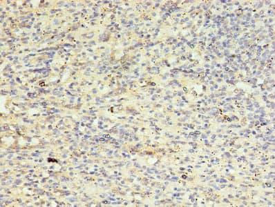 AURKB / Aurora-B Antibody