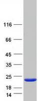 Human DCTD / dCMP Deaminase Protein (Recombinant Myc-DDK (Flag))