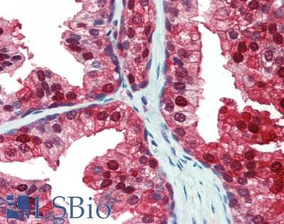 IHC-plus™ GLO1 / Glyoxalase I Antibody (aa83-184)