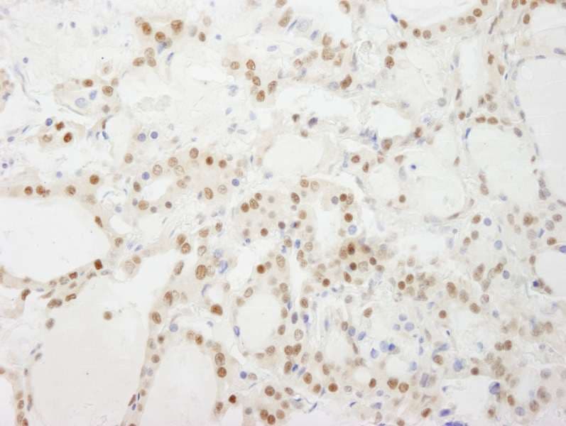 GTF3C4 Antibody (aa625-675)