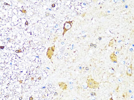 Polyclonal Rabbit anti-Human TH / Tyrosine Hydroxylase Antibody (IHC, WB)