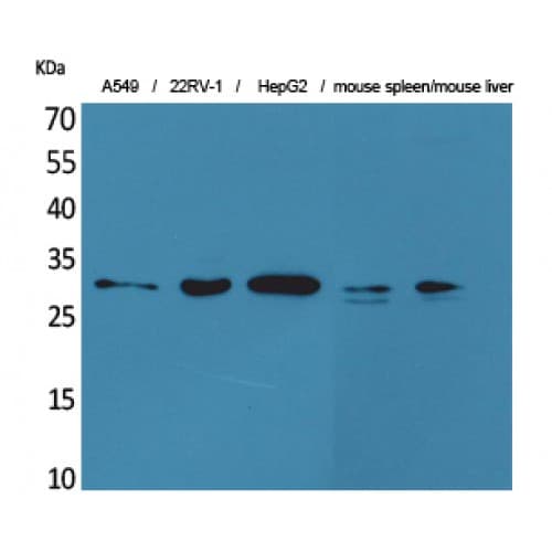 BAFF / TNFSF13B Antibody (Internal)