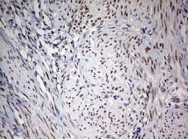 FEN1 Antibody (aa117-380, clone OTI1F3)