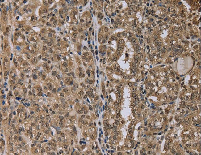 NALP6 / NLRP6 Antibody