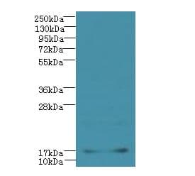 Polyclonal Rabbit anti-Human DAT1 / LMO3 Antibody (IHC, WB)