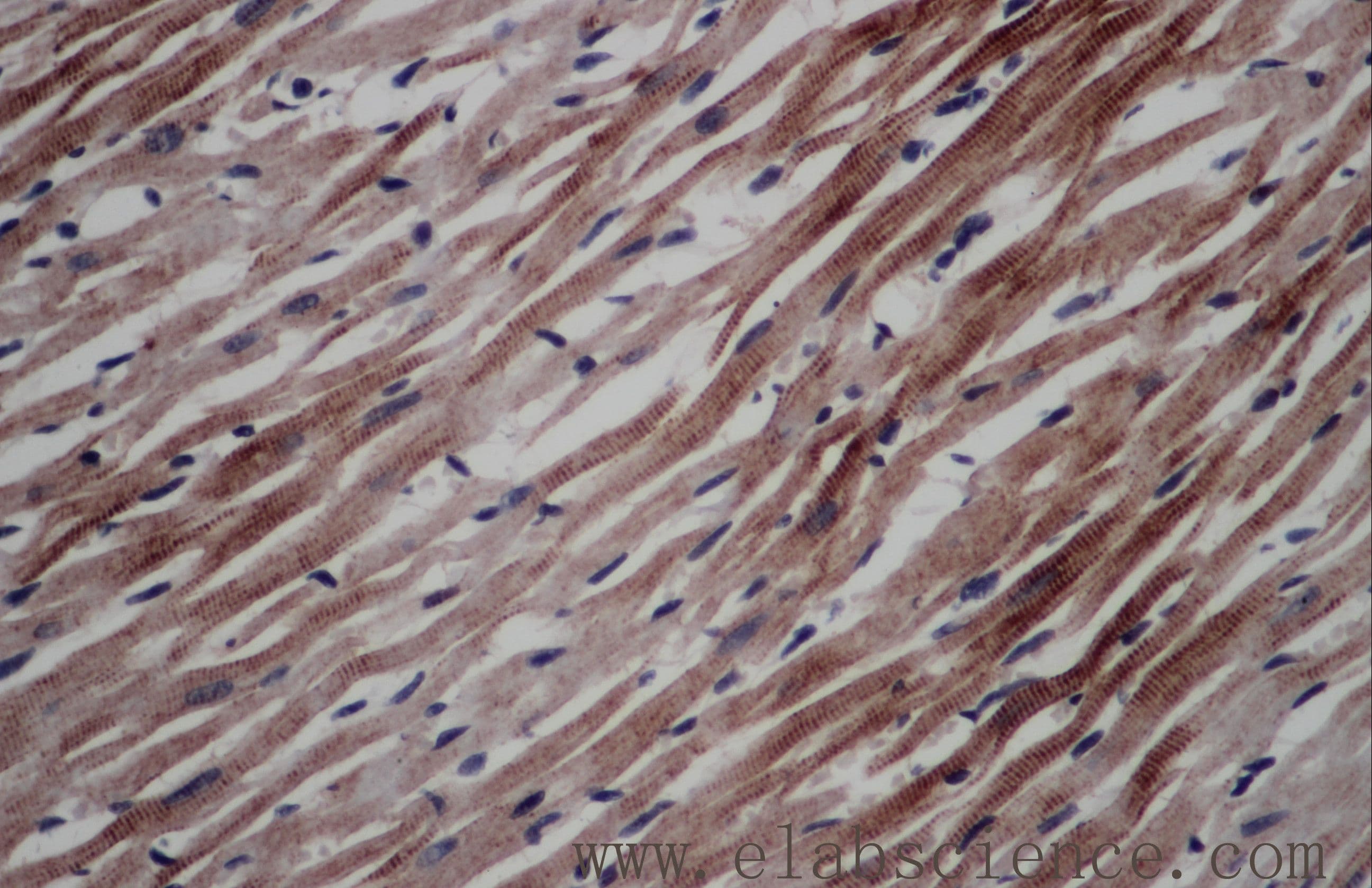 Polyclonal Rabbit anti-Human ART4 Antibody (IHC, WB)