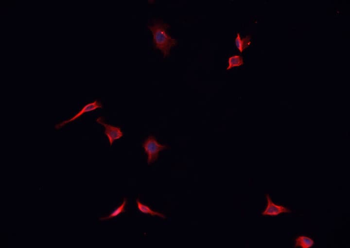 TACC1 Antibody