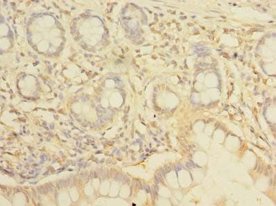 NHLRC2 Antibody