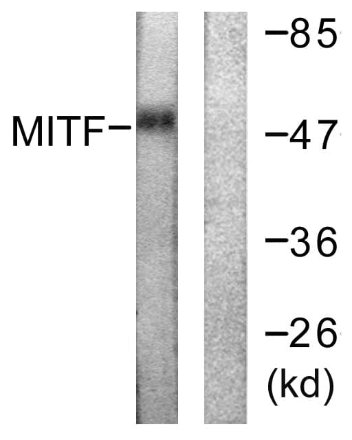 Polyclonal Rabbit anti-Human MITF Antibody (aa151-200, IHC, IF, WB)