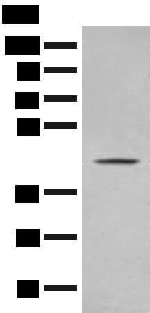Polyclonal Rabbit anti-Human OLA1 Antibody (IHC, WB)