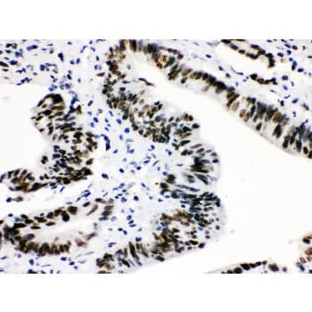 CTBP2 Antibody (aa321-445)