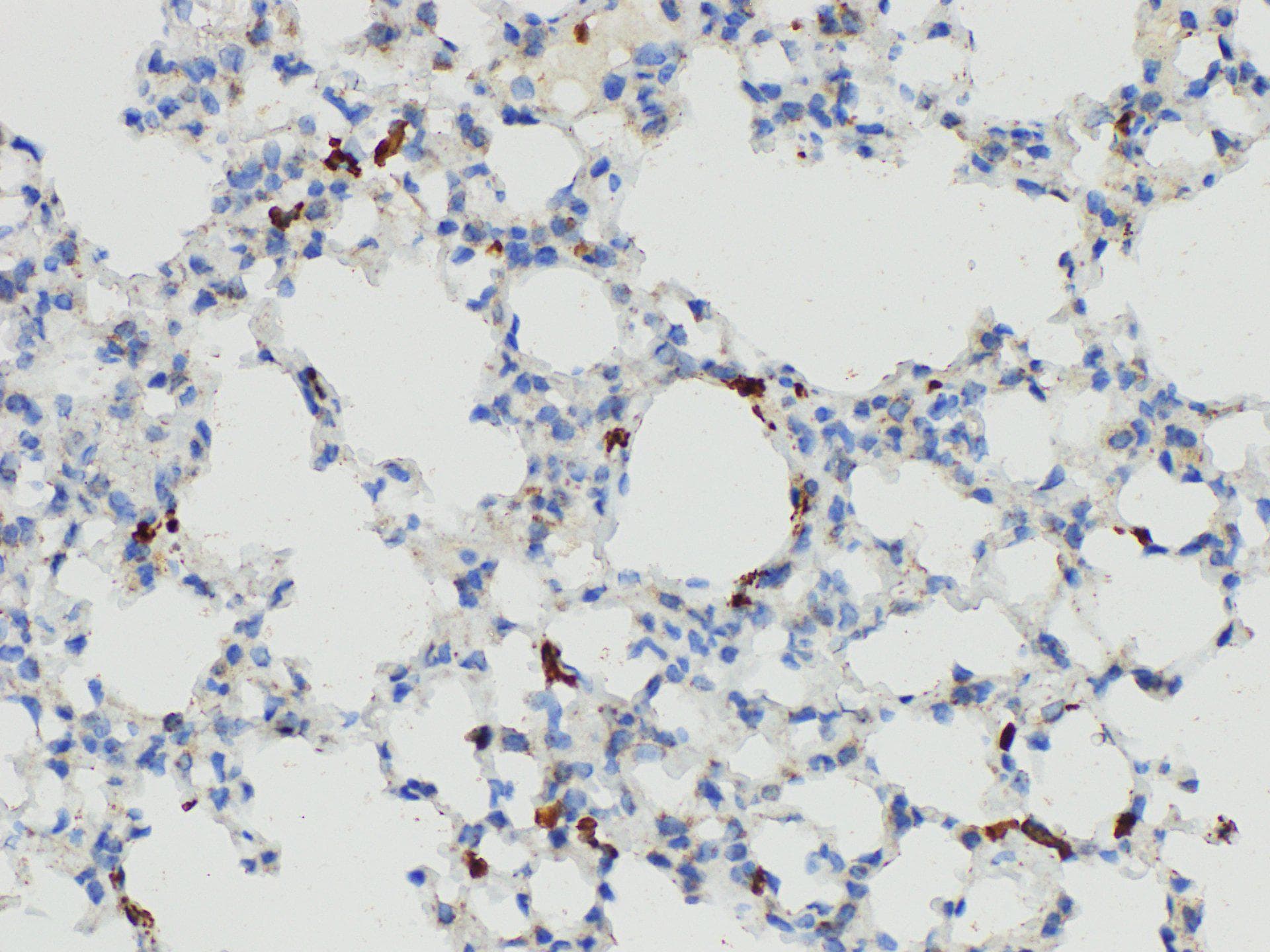 S100A4 / FSP1 Antibody