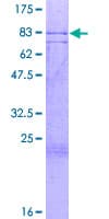 Human ZNF280A Protein (Recombinant GST)