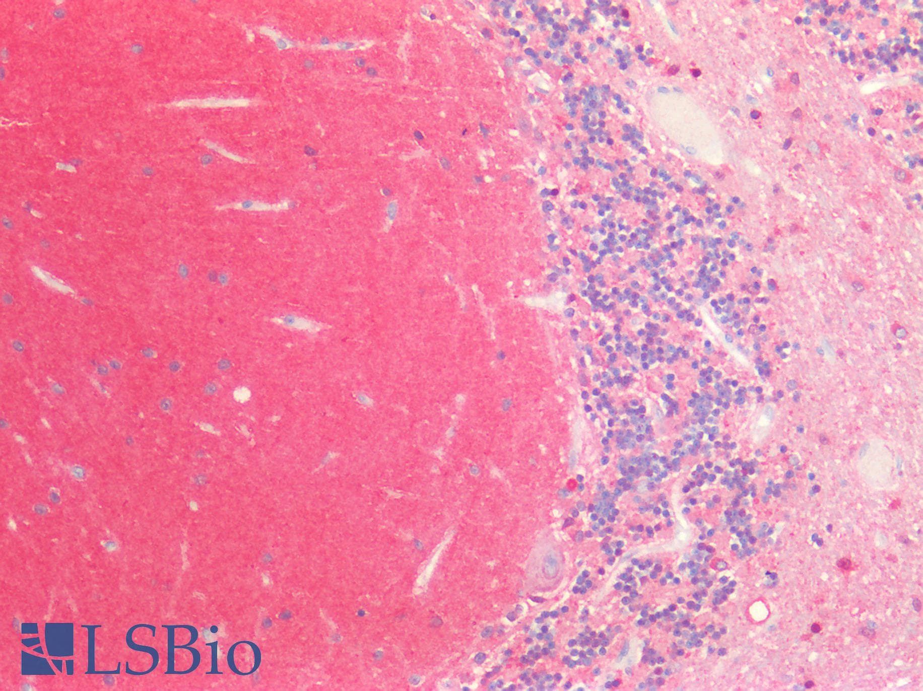 IHC-plus™ MAPT / Tau Antibody (Internal)