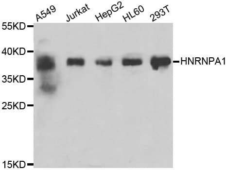 Polyclonal Rabbit anti-Human HNRPA1 / HnRNP A1 Antibody (IHC, IF, WB)