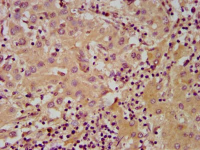 Polyclonal Rabbit anti-Human NUDT5 Antibody (IHC, IF)