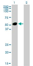 Monoclonal Mouse anti-Human GATA2 Antibody (clone 2D11, IF, WB)