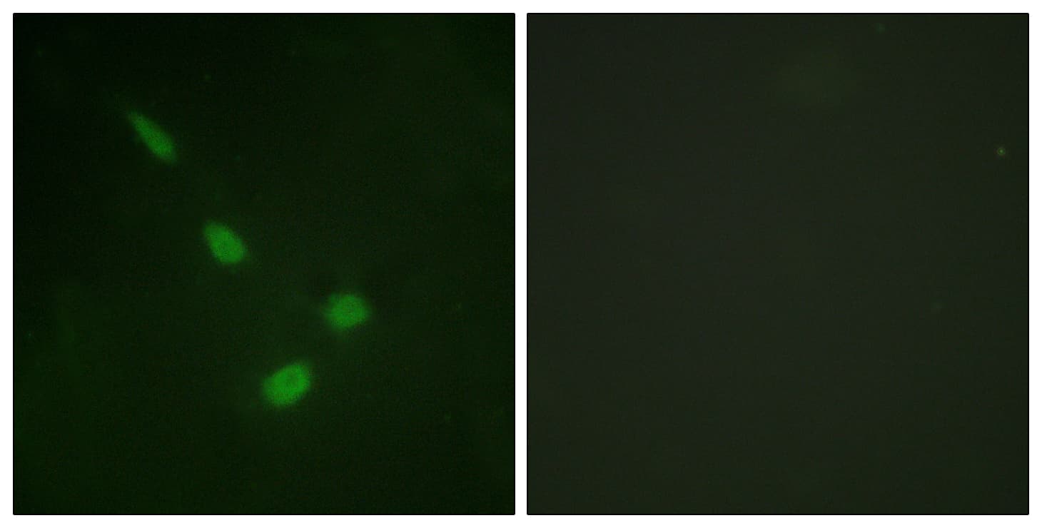 MAPK15 / ERK7 Antibody (aa141-190)