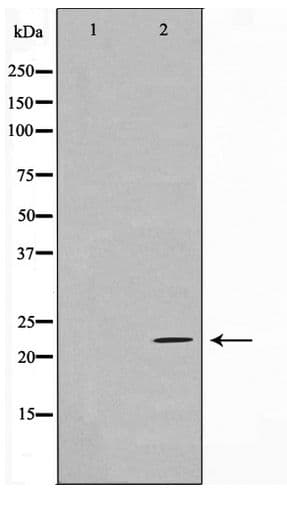 EFNA2 / Ephrin A2 Antibody