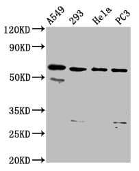 Polyclonal Rabbit anti-Human DDX28 Antibody (WB)