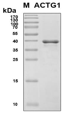 Human ACTG1 / Gamma Actin Protein (Recombinant 6His, N-terminus)