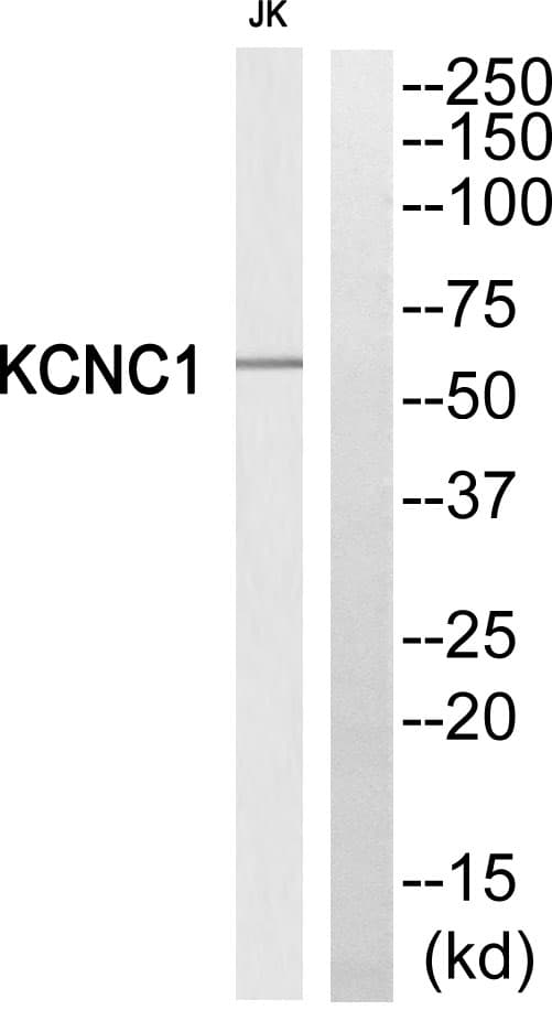 Polyclonal Rabbit anti-Human KCNC1 / Kv3.1 Antibody (WB)