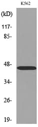 Polyclonal Rabbit anti-Human CD177 Antibody (WB)