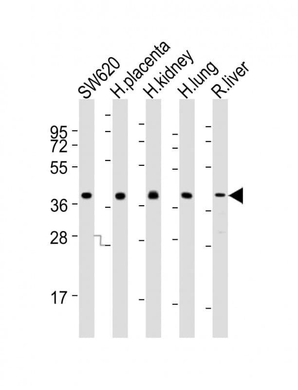 Polyclonal Rabbit anti-Human LPP3 / PPAP2B Antibody (aa3-37, WB)