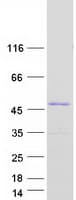 Human ECI2 / PECI Protein (Recombinant Myc-DDK (Flag))