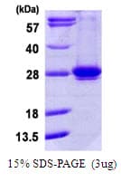 Human RAB35 Protein (Recombinant His)