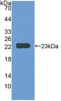 CD47 Antibody (aa18-219)