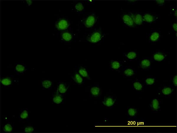 IHC-plus™ TOPORS Antibody (clone 5G11)