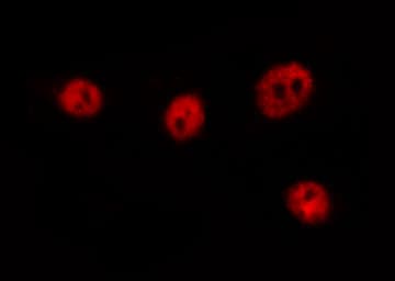 Polyclonal Rabbit anti-Human FOXO4 / AFX1 Antibody (IHC, IF, WB)