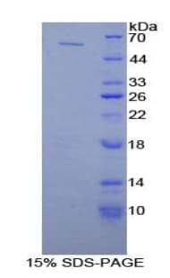 Human PLAA Protein (Recombinant His-GST)