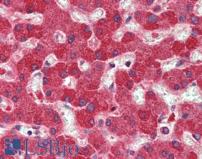 IHC-plus™ Polyclonal Rabbit anti-Human SLC22A1 Antibody (IHC, WB)