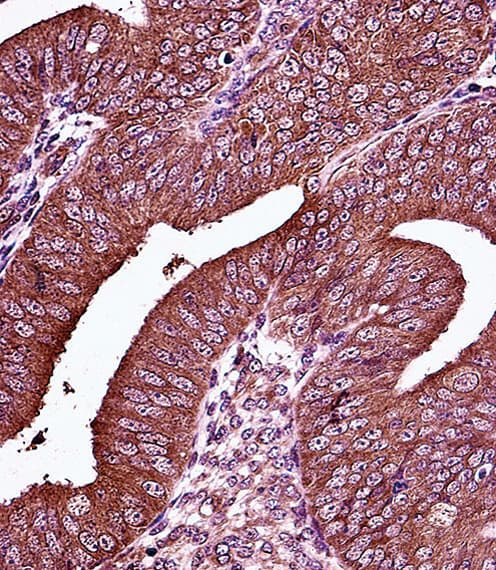 ER Alpha / Estrogen Receptor Antibody (aa246-273)