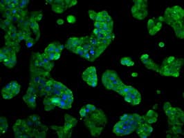 GBE1 Antibody (clone OTI4A1)