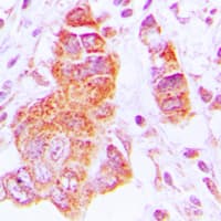 Polyclonal Rabbit anti-Human CSNK1E / CK1 Epsilon Antibody (Internal, IHC, IF, WB)