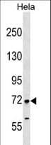 FIGNL1 Antibody (aa12-40)