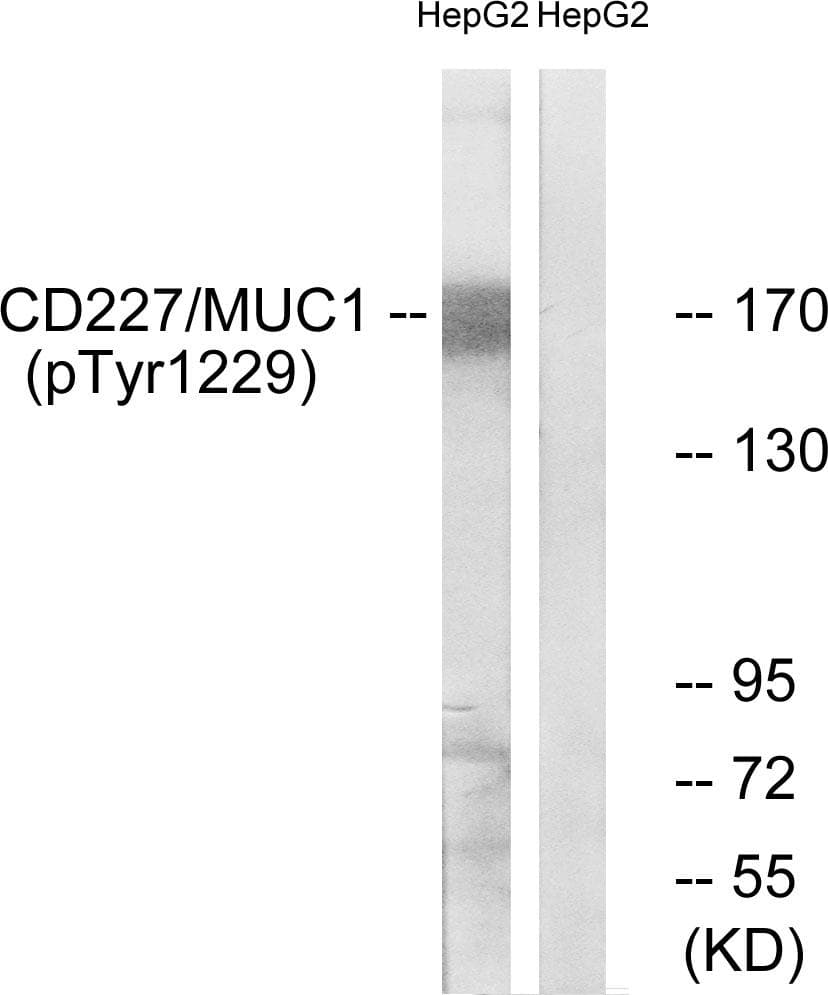 Polyclonal Rabbit anti-Human EMA / MUC1 Antibody (phospho-Tyr1229, IHC, IF, WB)