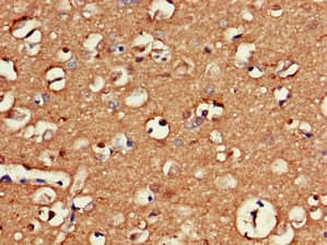 GAS7 Antibody