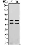 Polyclonal Rabbit anti-Human LMNA / Lamin A+C Antibody (phospho-Ser392, IHC, IF, WB)