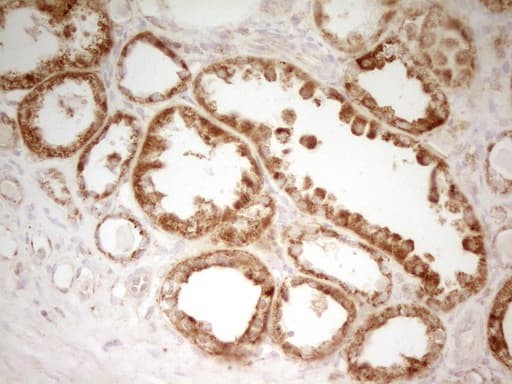 Monoclonal Mouse anti-Human MRRF Antibody (clone OTI1D5, aa56-262, IHC, WB)