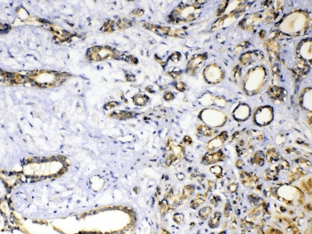 Polyclonal Rabbit anti-Human SOD3 Antibody (IHC)