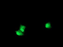 RPS6KB1 / P70S6K / S6K Antibody (clone OTI6B2)