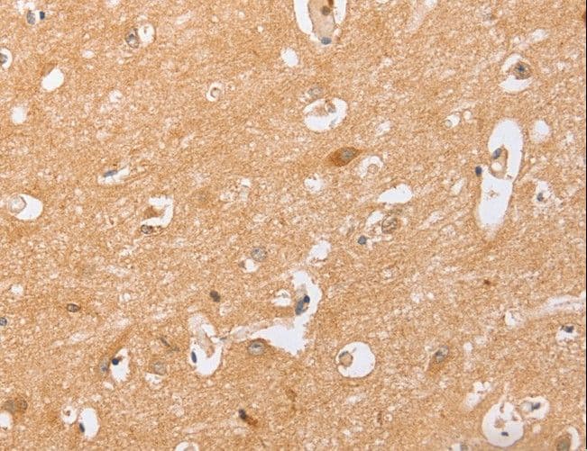 CD157 Antibody