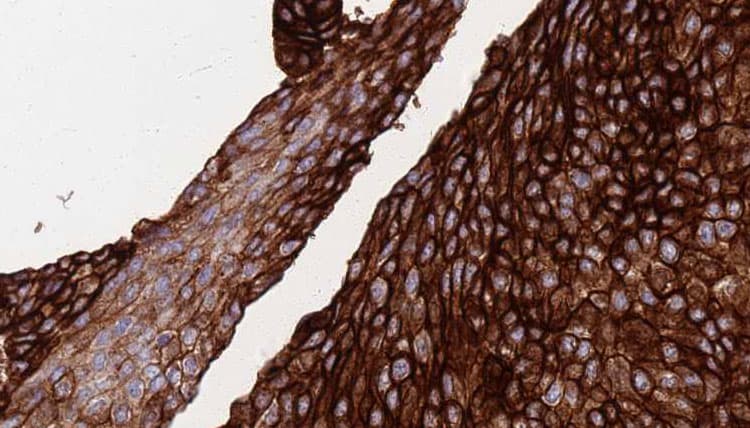 FASN / Fatty Acid Synthase Antibody