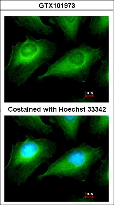Polyclonal Rabbit anti-Human OTUB1 / OTU1 Antibody (aa1-149, WB)