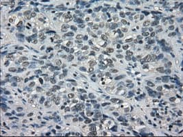 Monoclonal Mouse anti-Human BUB1B / BubR1 Antibody (clone OTI15E11, IHC, IF, WB)